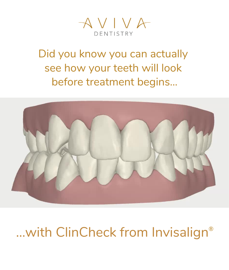 Aviva - ClinCheck Post (791 x 932 px)